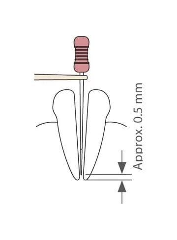 Root ZX mini measurement step three