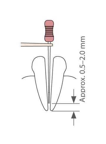 Root ZX mini measurement step two